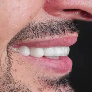 Hollywood Smile -kings medical center