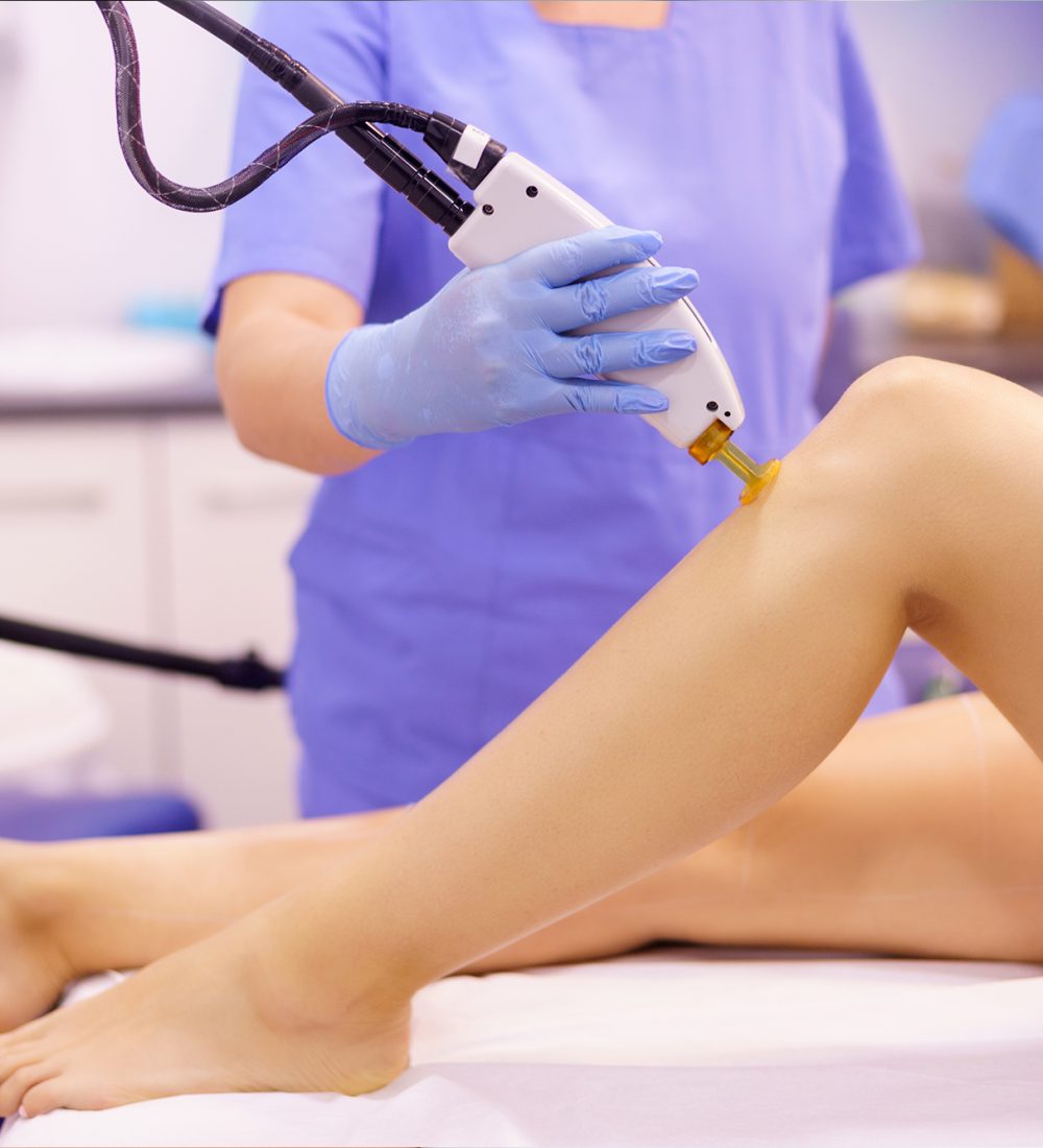 laser hair removal